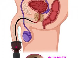 尿孔调教扩张_探索尿孔调教扩张的技巧和注意事项