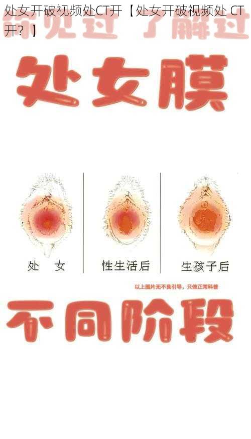 处女开破视频处CT开【处女开破视频处 CT 开？】